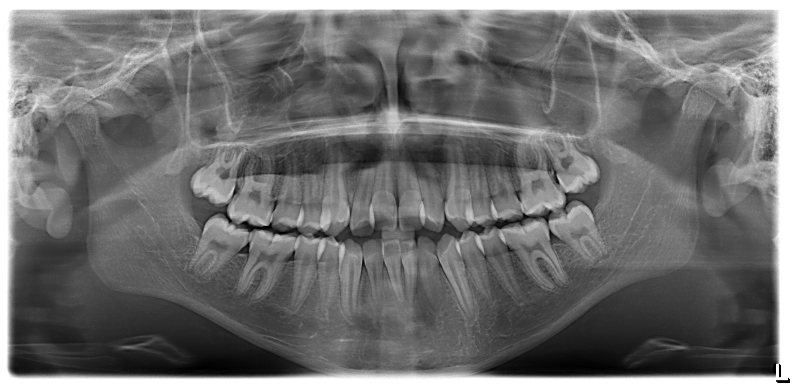 Servicios de Radiología Dental Digital